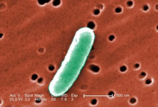 Слика од Escherichia