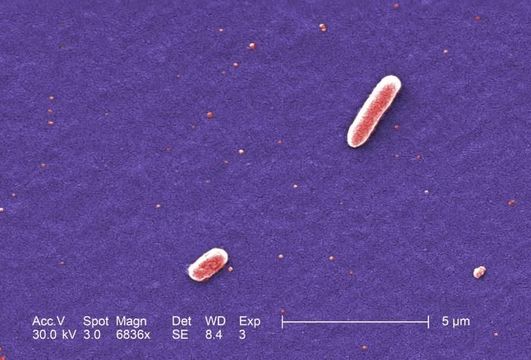 Image of Escherichia