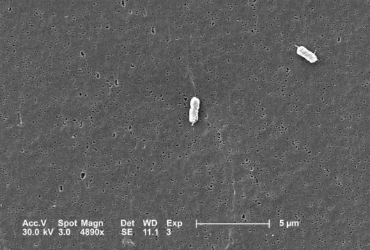 Escherichia resmi