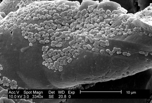 Escherichia resmi