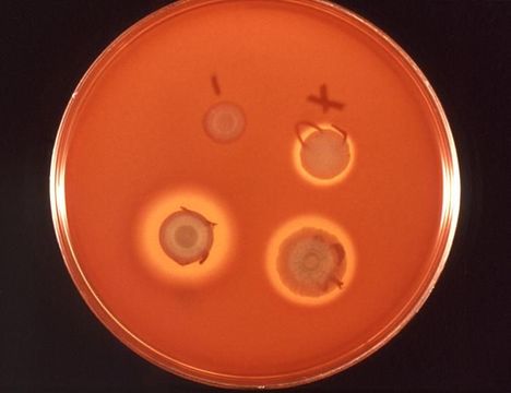 Plancia ëd Serratia