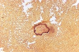Image of <i>Propionibacterium propionicum</i>