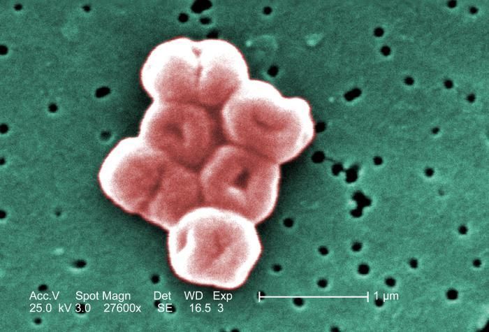 Image of Acinetobacter baumannii