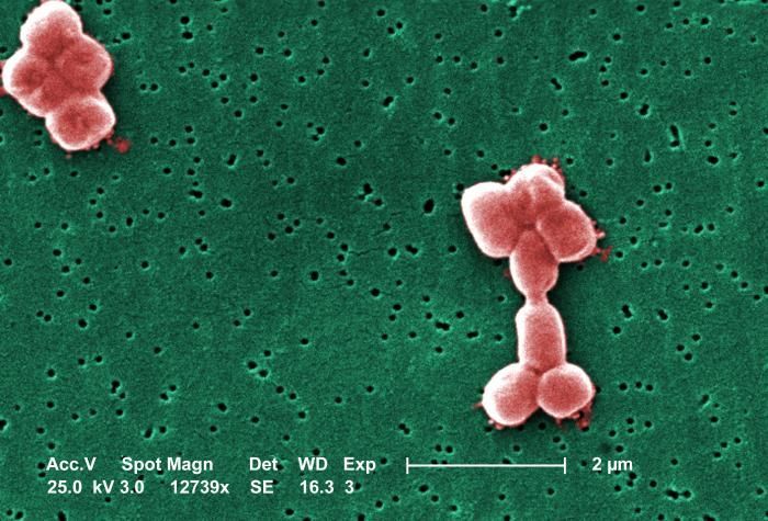 Image de Acinetobacter baumannii