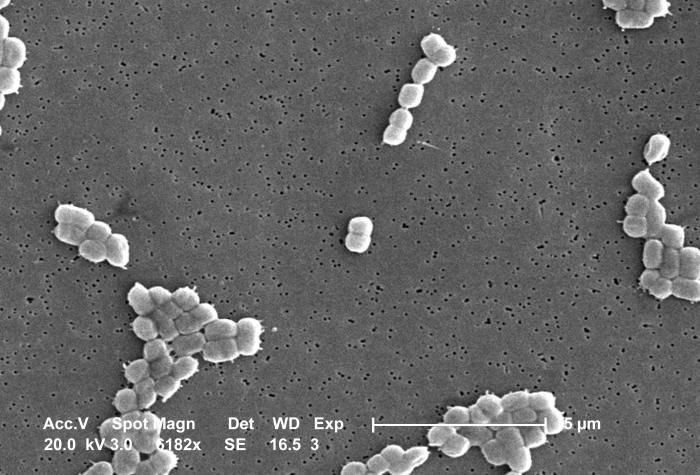 Imagem de Acinetobacter baumannii