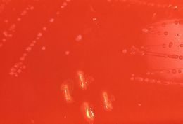 Image of Streptococcus pyogenes