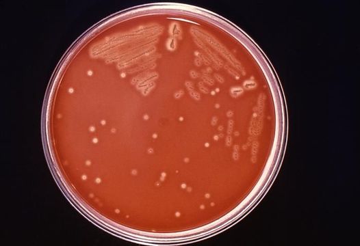 Image de Streptococcus pyogenes