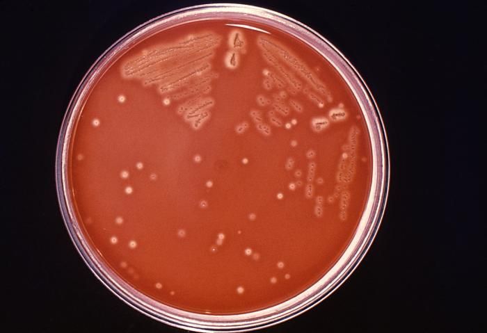 Imagem de Streptococcus pyogenes