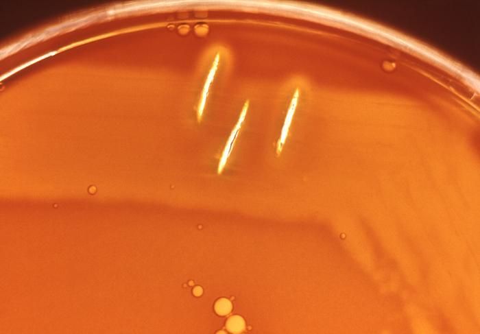 Image of Streptococcus anginosus
