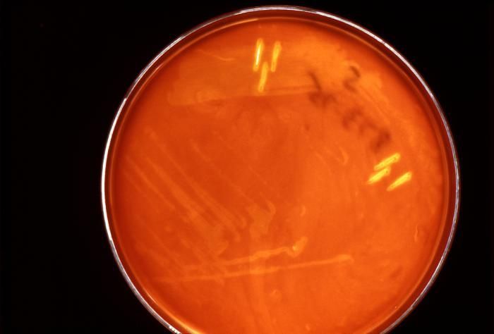 Image de Streptococcus anginosus