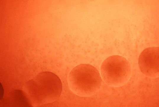 Image of Streptococcus anginosus