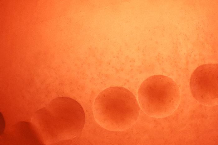 Image de Streptococcus anginosus