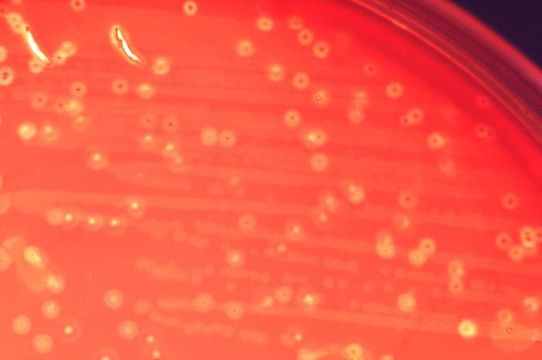 Image of Streptococcus anginosus