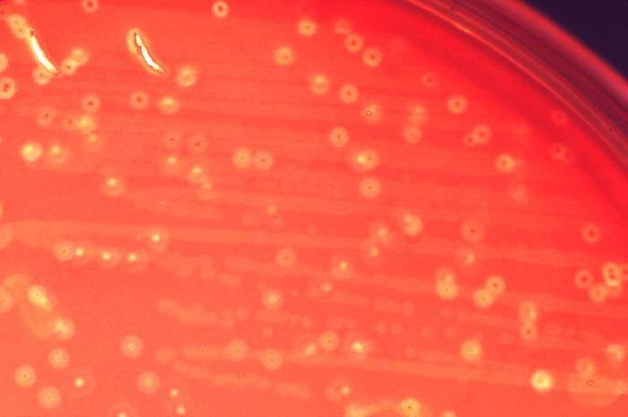 Image de Streptococcus anginosus
