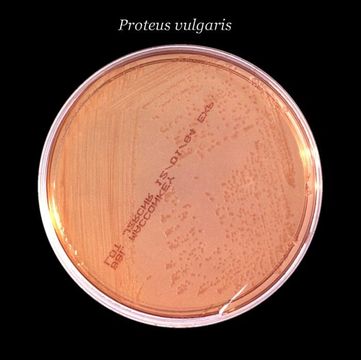 Image of Proteus vulgaris