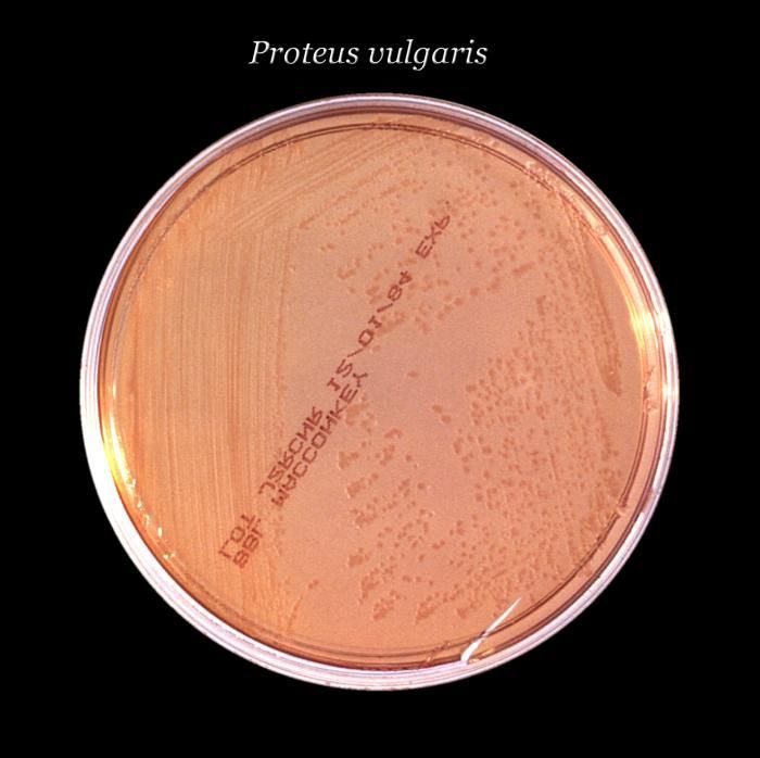 Image de Proteus vulgaris