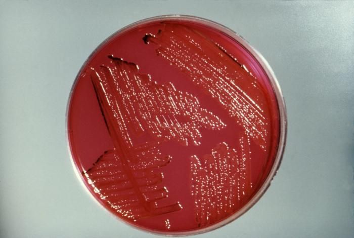 Image of <i>Citrobacter freundii</i> (Braak 1928) Werkman & Gillen 1932