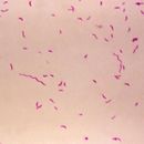 Image of Campylobacter fetus