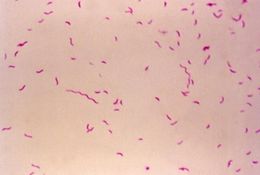 Sivun Campylobacter fetus kuva