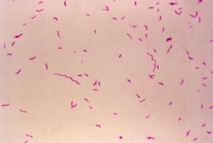 Image de Campylobacter fetus