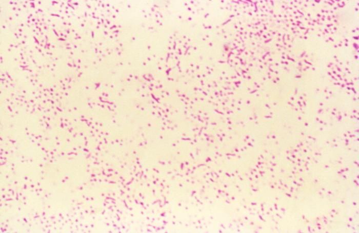 Sivun Campylobacter jejuni kuva