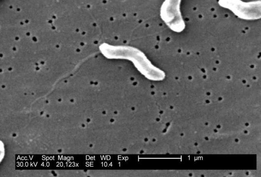 Image of Campylobacter jejuni