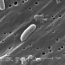 Image of Vibrio cholerae