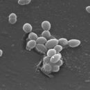 Imagem de Enterococcus faecalis