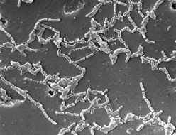 Sivun <i>Mycobacterium chelonae</i> kuva