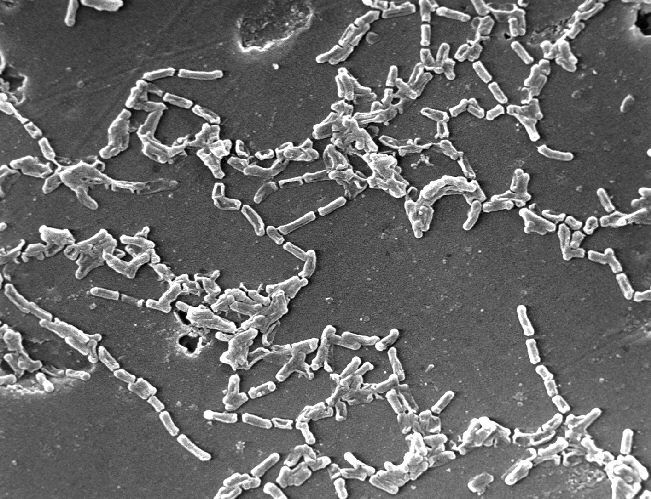 Sivun <i>Mycobacterium chelonae</i> kuva