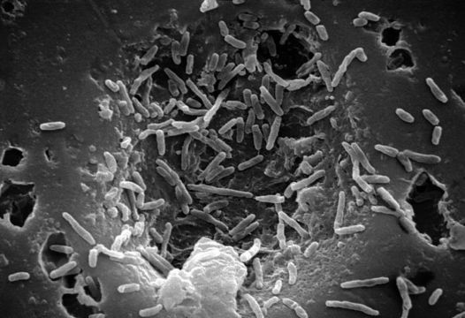 Image of <i>Mycobacterium chelonae</i>