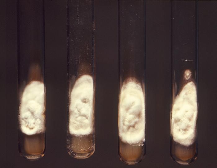 Image of Histoplasma capsulatum Darling 1906
