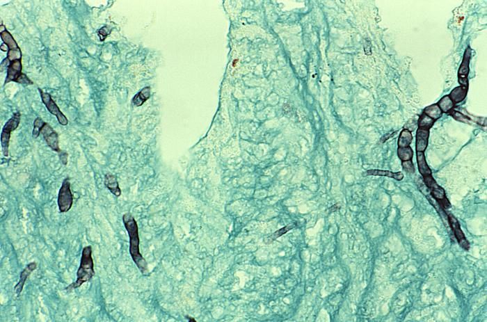 Imagem de Tritirachium roseum J. F. H. Beyma 1942