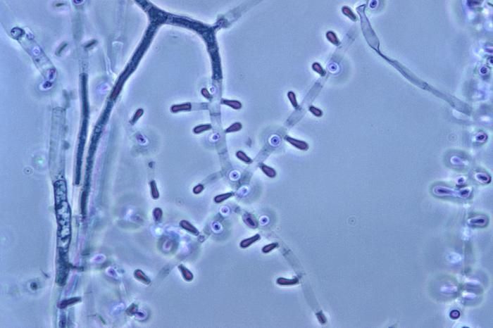 صورة Trichophyton soudanense Joyeux 1912