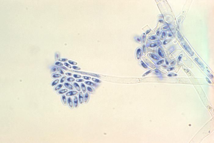 Image of <i>Acremonium falciforme</i> (Carrion) W. Gams 1971