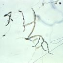 Image of Bispora betulina (Corda) S. Hughes 1958