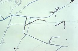 Image of Bispora betulina (Corda) S. Hughes 1958