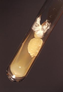 Слика од Cryptococcus