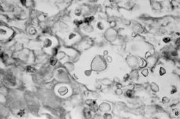 Image of Cryptococcus