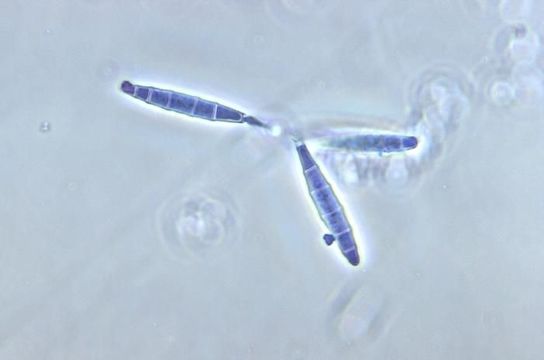 Sivun <i>Microsporum persicolor</i> (Sabour.) Guiart & Grigoraki 1928 kuva