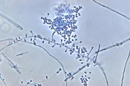 Image of <i>Microsporum persicolor</i> (Sabour.) Guiart & Grigoraki 1928