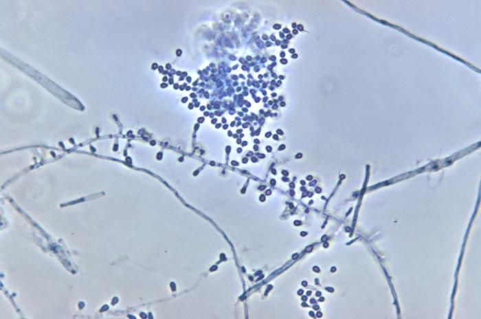 Image of <i>Microsporum persicolor</i> (Sabour.) Guiart & Grigoraki 1928