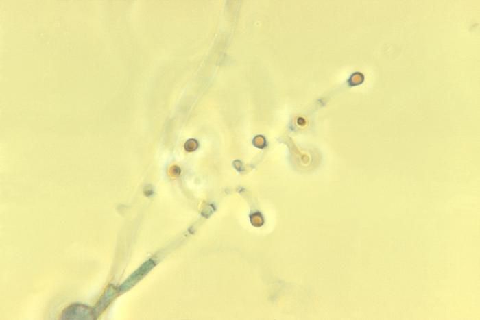 Image of <i>Microsporum persicolor</i> (Sabour.) Guiart & Grigoraki 1928