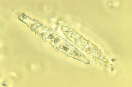 Image of <i>Microsporum persicolor</i> (Sabour.) Guiart & Grigoraki 1928