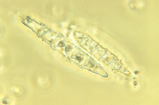 Imagem de <i>Microsporum persicolor</i> (Sabour.) Guiart & Grigoraki 1928