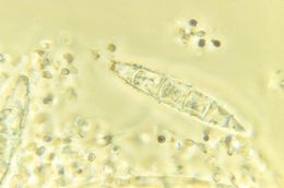 Image of <i>Microsporum persicolor</i> (Sabour.) Guiart & Grigoraki 1928