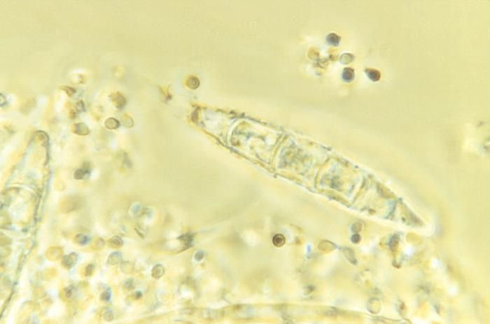 Image of <i>Microsporum persicolor</i> (Sabour.) Guiart & Grigoraki 1928