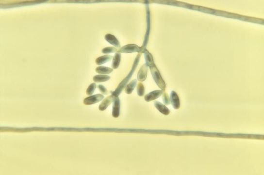 Image of Exophiala brunnea Papendorf 1969