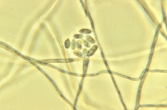 Image of Exophiala brunnea Papendorf 1969