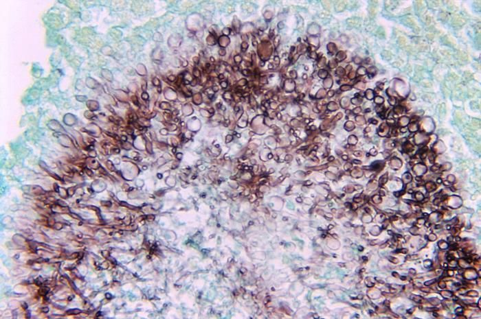 Pseudallescheria boydii (Shear) McGinnis, A. A. Padhye & Ajello 1982 resmi